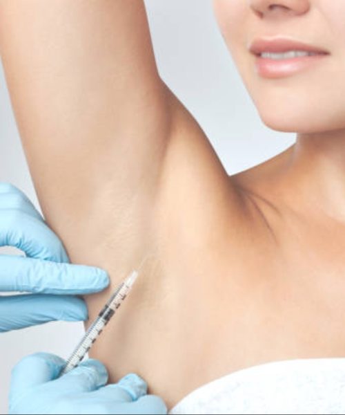 the-doctor-makes-intramuscular-injections-of-botulinum-toxin-in-the-underarm-area-against-jpg-612×408-